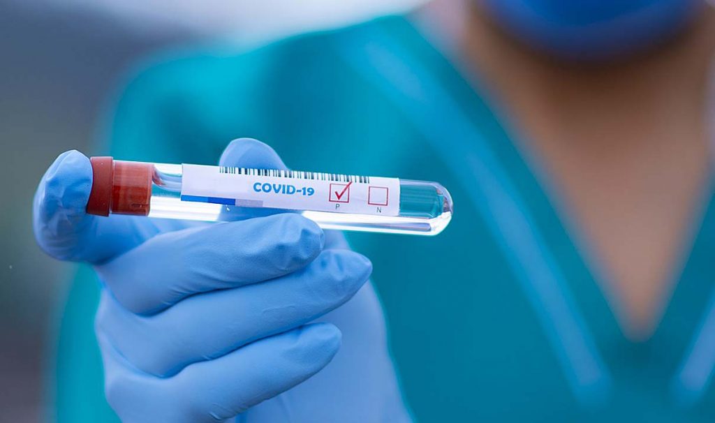 Tamponi molecolari anti covid in Sardegna