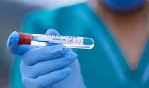 Tamponi molecolari anti covid in Sardegna