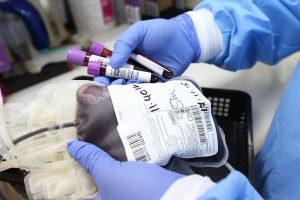 Plasma iperimmune in Sardegna