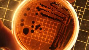 Tre focolai dopo pasti contaminati