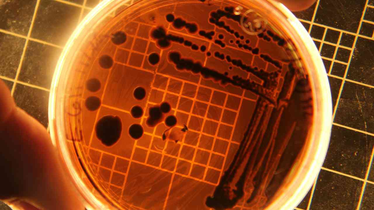 Cagliari, allarme salmonella | Tre focolai dopo pasti contaminati: coinvolti locali e centro riabilitazione
